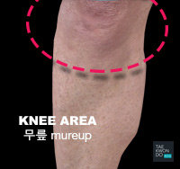 Knee ( 무릎 mureup )